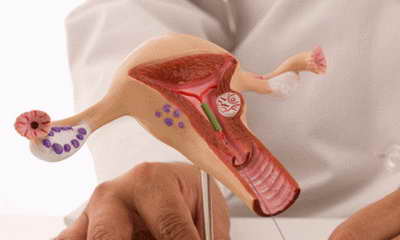 гипоплазия матки степени