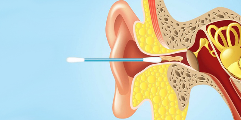 Серные пробки как удалить